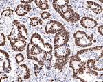 Ki-67 Antibody in Immunohistochemistry (Paraffin) (IHC (P))