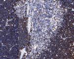 Ki-67 Antibody in Immunohistochemistry (Paraffin) (IHC (P))