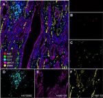 Ki-67 Antibody in Multiplex Immunohistochemistry (mIHC)