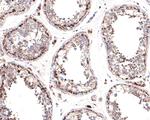 CECR5 Antibody in Immunohistochemistry (Paraffin) (IHC (P))
