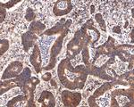 PEX11B Antibody in Immunohistochemistry (Paraffin) (IHC (P))