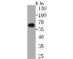 CoA Synthase Recombinant Rabbit Monoclonal Antibody (JE58-56)