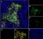 CD20 Antibody in Immunohistochemistry (Paraffin) (IHC (P))