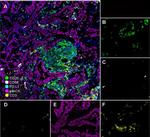 CD20 Recombinant Rabbit Monoclonal Antibody (PD00-02)
