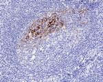 CD23 Antibody in Immunohistochemistry (Paraffin) (IHC (P))