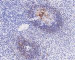 CD23 Antibody in Immunohistochemistry (Paraffin) (IHC (P))