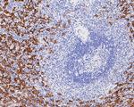 CD16 Antibody in Immunohistochemistry (Paraffin) (IHC (P))