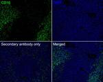 CD16 Antibody in Immunohistochemistry (Paraffin) (IHC (P))