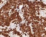 c-Kit Antibody in Immunohistochemistry (Paraffin) (IHC (P))