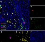 c-Kit Antibody in Multiplex Immunohistochemistry (mIHC)