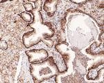 CD47 Antibody in Immunohistochemistry (Paraffin) (IHC (P))