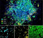 CD21 Antibody in Multiplex Immunohistochemistry (mIHC)