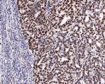 MSH6 Recombinant Rabbit Monoclonal Antibody (PD00-26)