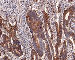 SQSTM1 Antibody in Immunohistochemistry (Paraffin) (IHC (P))