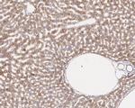 SQSTM1 Antibody in Immunohistochemistry (Paraffin) (IHC (P))