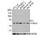 SQSTM1 Antibody in Western Blot (WB)