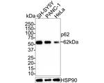 SQSTM1 Antibody in Western Blot (WB)
