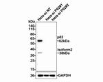 SQSTM1 Antibody in Western Blot (WB)