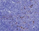 Mesothelin Antibody in Immunohistochemistry (Paraffin) (IHC (P))