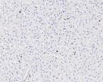 Stathmin 1 Antibody in Immunohistochemistry (Paraffin) (IHC (P))