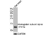 Hemoglobin alpha Antibody in Western Blot (WB)