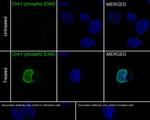 Phospho-CHK1 (Ser345) Antibody in Immunocytochemistry (ICC/IF)