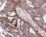 delta Catenin Antibody in Immunohistochemistry (Paraffin) (IHC (P))
