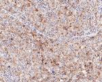 delta Catenin Antibody in Immunohistochemistry (Paraffin) (IHC (P))