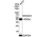 MAGE1 Recombinant Rabbit Monoclonal Antibody (PD00-50)