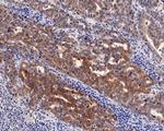 CTAG1B Recombinant Rabbit Monoclonal Antibody (PD00-87)