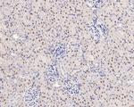 NPM1 Antibody in Immunohistochemistry (Paraffin) (IHC (P))