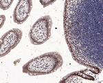 NPM1 Antibody in Immunohistochemistry (Paraffin) (IHC (P))