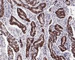 NPM1 Antibody in Immunohistochemistry (Paraffin) (IHC (P))