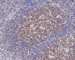 LMO2 Antibody in Immunohistochemistry (Paraffin) (IHC (P))