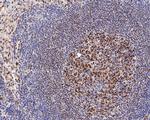 LMO2 Antibody in Immunohistochemistry (Paraffin) (IHC (P))
