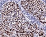 p53 Recombinant Rabbit Monoclonal Antibody (PD01-32)