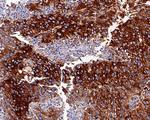 NAPSA Antibody in Immunohistochemistry (Paraffin) (IHC (P))