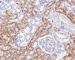 NAPSA Antibody in Immunohistochemistry (Paraffin) (IHC (P))