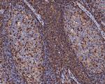 CD43 Recombinant Rabbit Monoclonal Antibody (PD01-28)