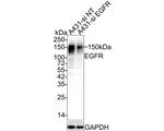 EGFR Antibody in Immunohistochemistry (Paraffin) (IHC (P))