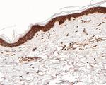 EGFR Antibody in Immunohistochemistry (Paraffin) (IHC (P))