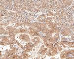 EGFR Antibody in Immunohistochemistry (Paraffin) (IHC (P))