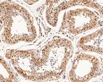 SMAD4 Antibody in Immunohistochemistry (Paraffin) (IHC (P))