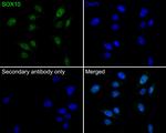 SOX10 Recombinant Rabbit Monoclonal Antibody (PDH0-03)