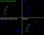 H4K8ac Recombinant Rabbit Monoclonal Antibody (PS01-25)