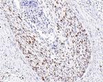 Ki-67 Antibody in Immunohistochemistry (Paraffin) (IHC (P))