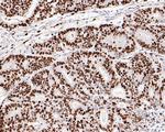 Ki-67 Antibody in Immunohistochemistry (Paraffin) (IHC (P))