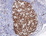 Ki-67 Antibody in Immunohistochemistry (Paraffin) (IHC (P))