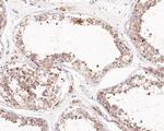 DLAT Antibody in Immunohistochemistry (Paraffin) (IHC (P))