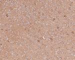 DLAT Antibody in Immunohistochemistry (Paraffin) (IHC (P))